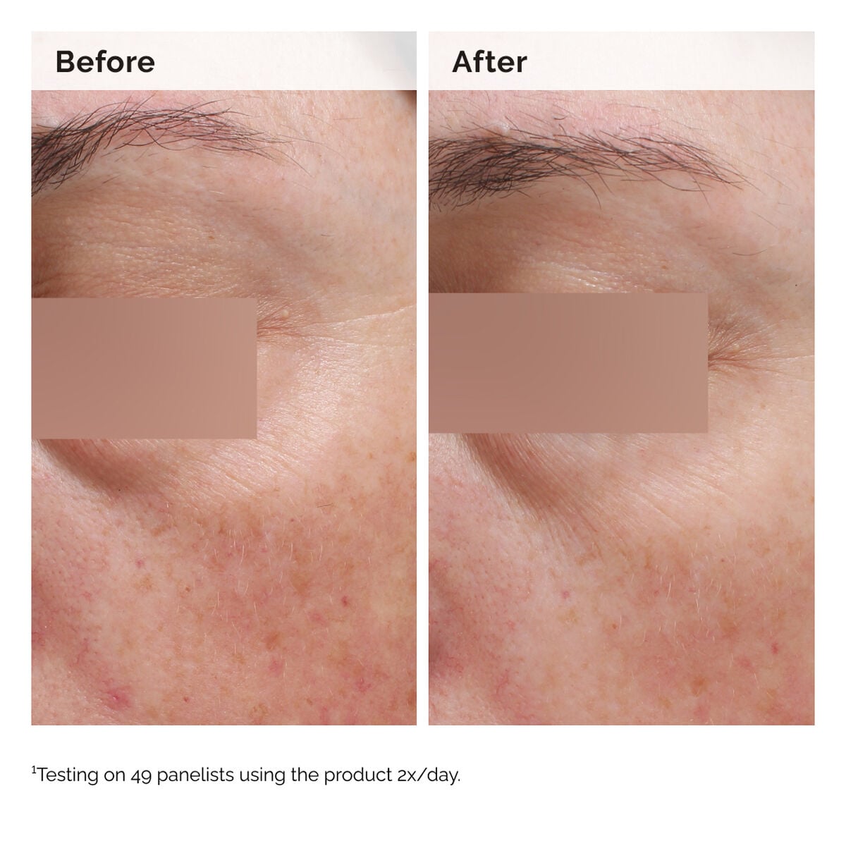 niacinamide-5-face-and-body-emulsion-z5 2024-08-23-ORD-Nia-5pct-Face-Body-B-A-Elasticity-Global-02-1x1.jpg