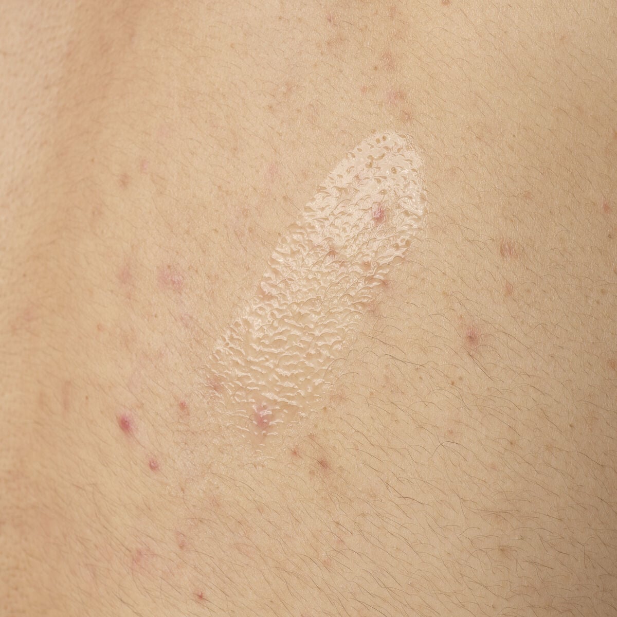 salicylic-acid-0-5-body-serum-o2 ORD-salicylic-acid-05-body-240ml-application.jpg