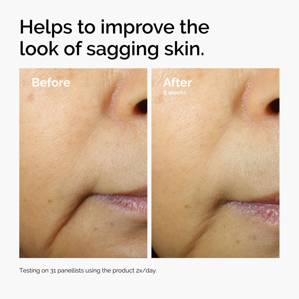 caffeine-3-escin-1-face-serum-x0 ord-caffeine-3pct-escin-1pct-face-serum-before-after-sagging.jpg