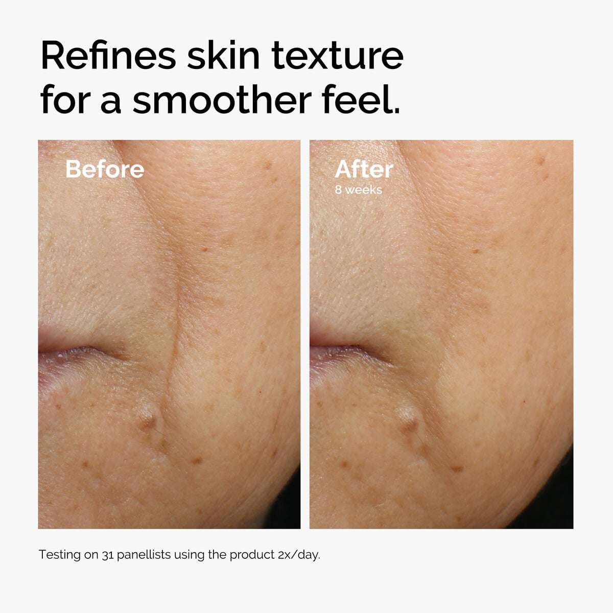 caffeine-3-escin-1-face-serum-x0 ord-caffeine-3pct-escin-1pct-face-serum-before-after-texture.jpg
