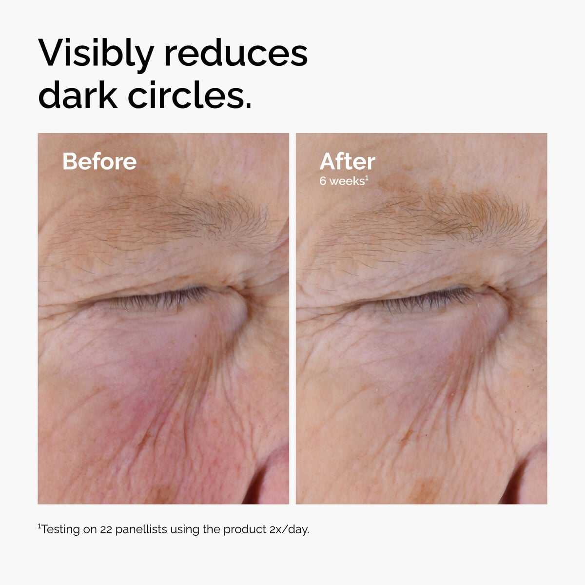 caffeine-solution-5-egcg-eye-serum-a9 ord-caffeine-solution-egcg-dark-circles-before-after.jpg