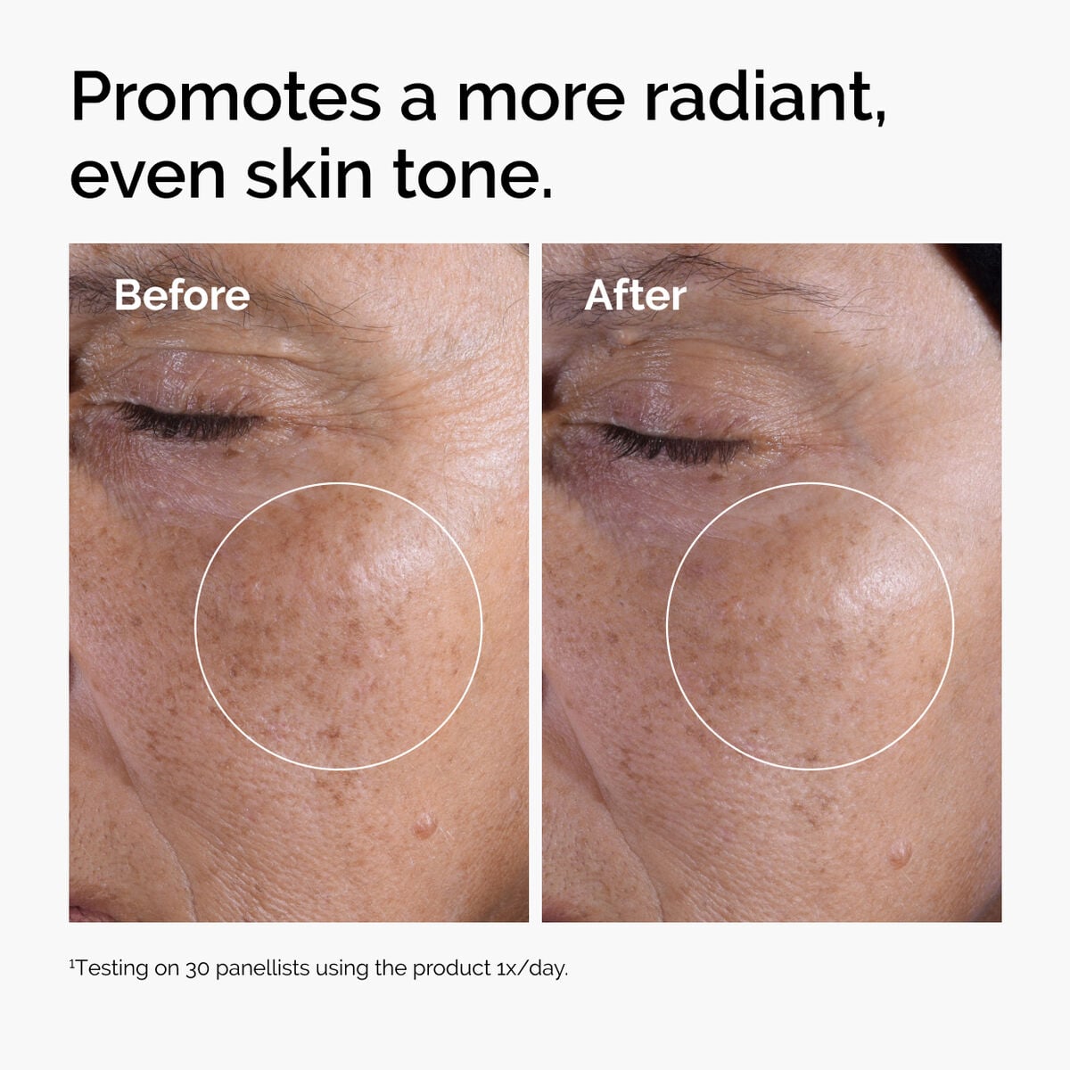 glycolic-acid-7-exfoliating-toner-u0 ord-glycolic-before-after-radiance.jpg