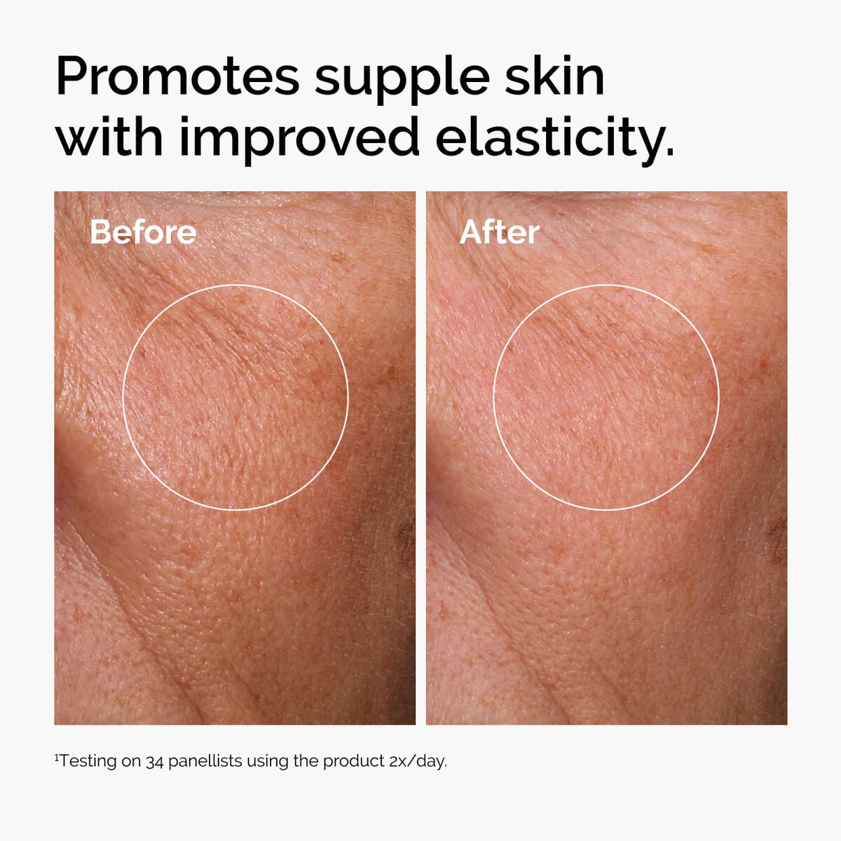 hyaluronic-acid-2-b5-with-ceramides-f6 ord-hyaluronic-acid-2pct-b5-hydrating-serum-before-after-elasticity.jpg