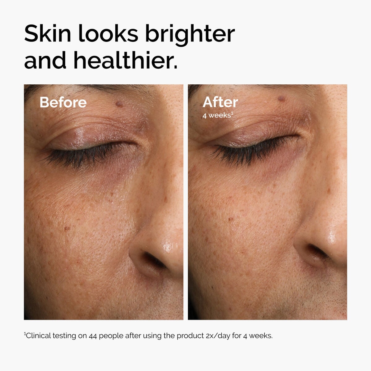 multi-antioxidant-radiance-serum-i9 ord-mars-before-after-healthy.jpg