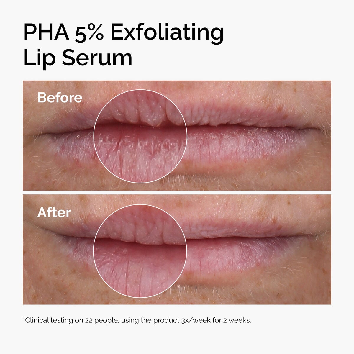 pha-5-exfoliating-lip-serum-n5 ord-pha-5pct-lip-exfoliating-serum-before-after.jpg