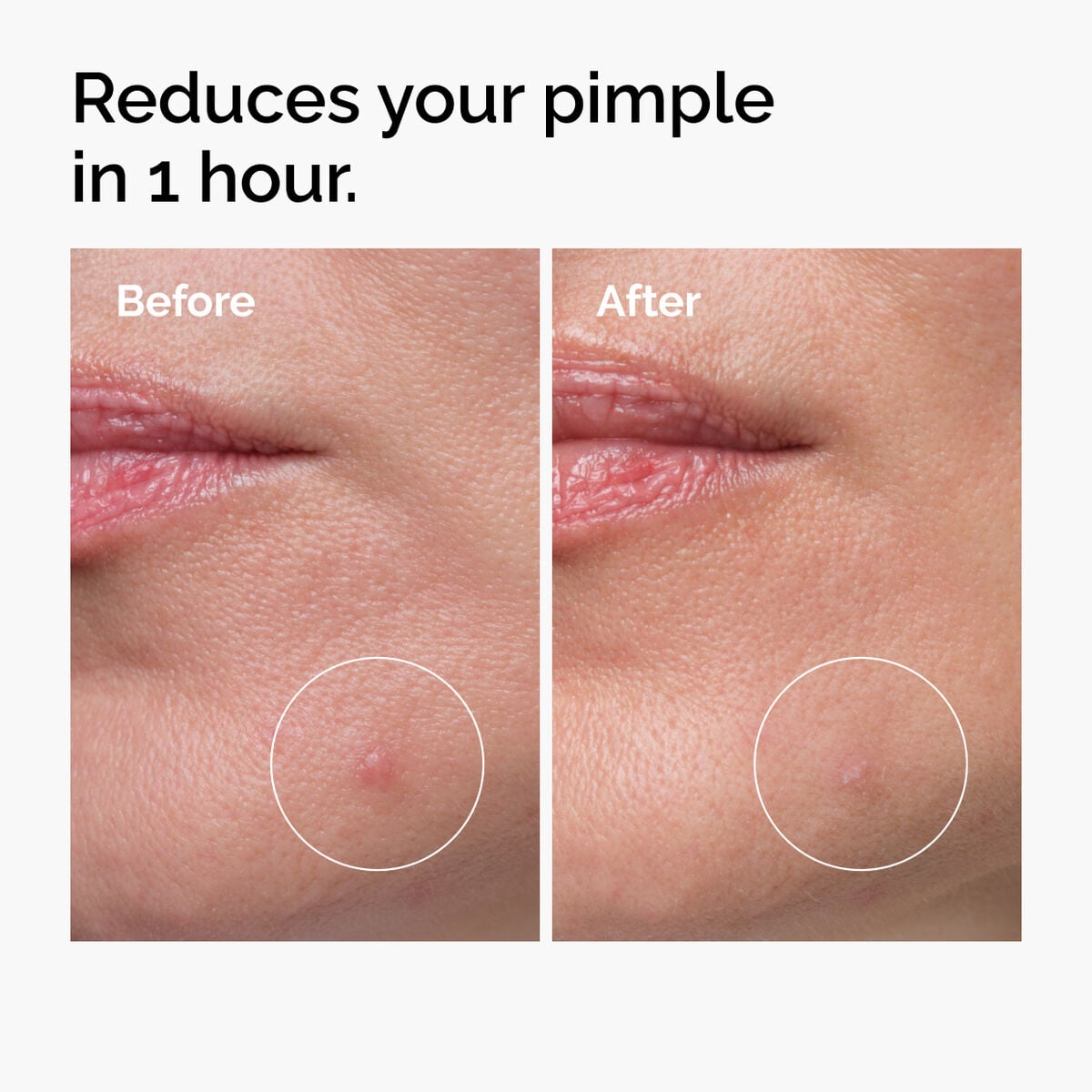 sulfur-10-powder-to-cream-concentrate-l2 ord-sulfur-10pct-powder-to-cream-concentrate-before-after-NA.jpg