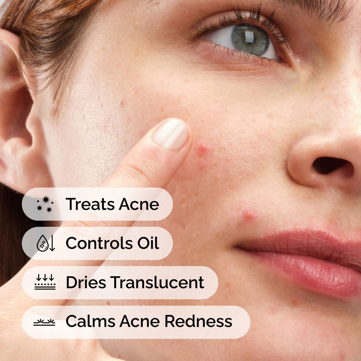 sulfur-10-powder-to-cream-concentrate-l2 ord-sulfur-10pct-powder-to-cream-concentrate-model-application-with-benefits-acne.jpg